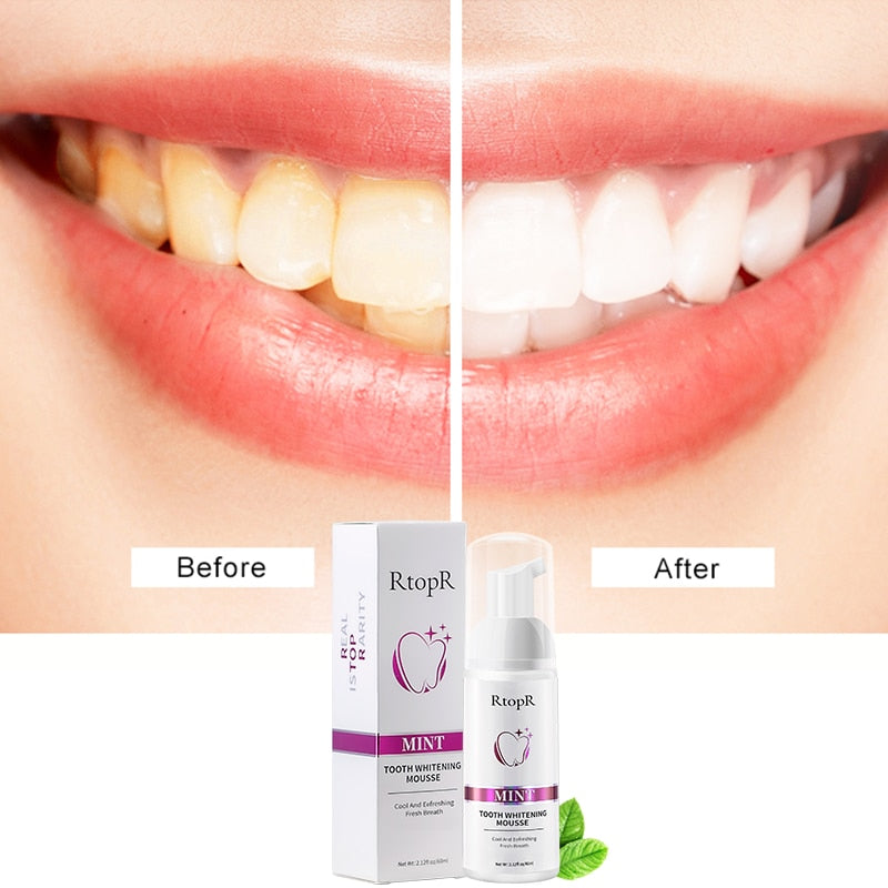 Teeth Whitening Mousse