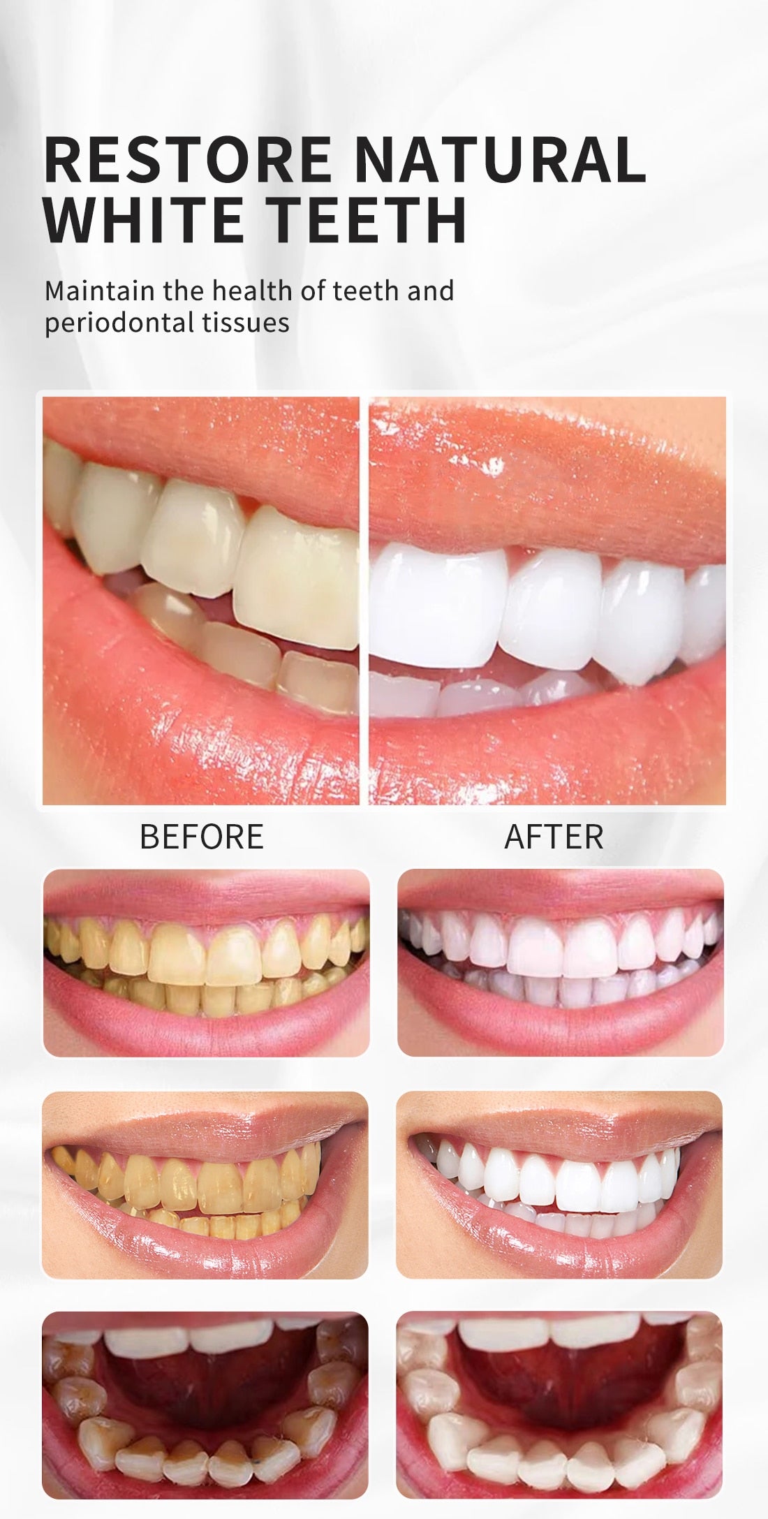 Teeth Whitening Mousse