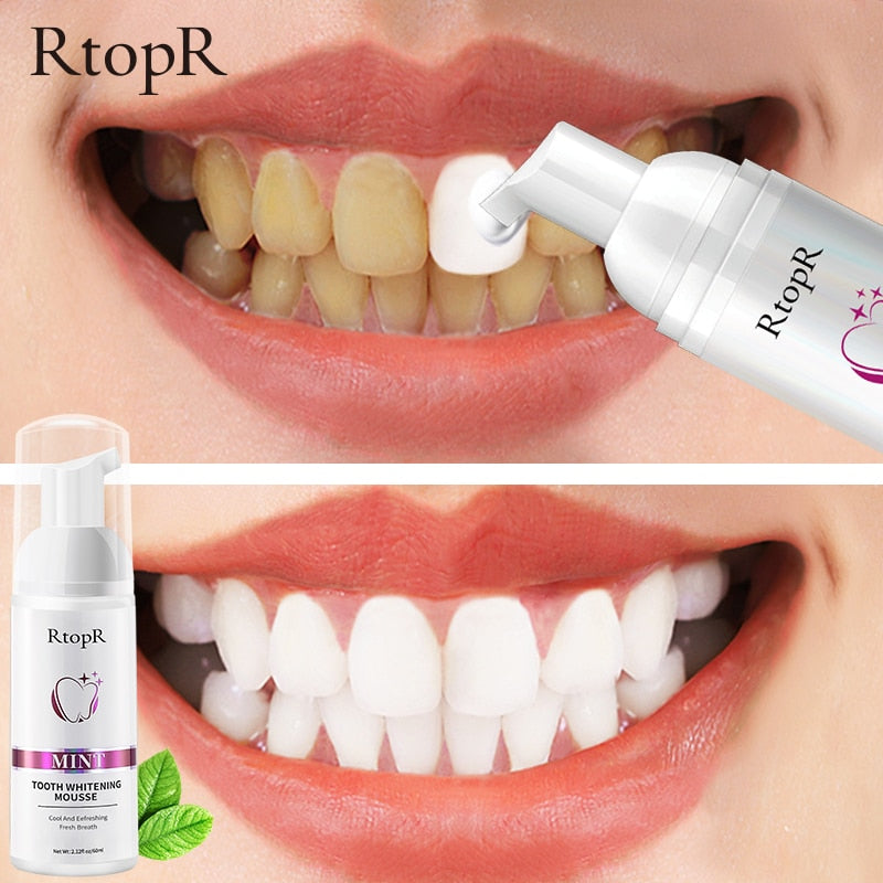 Teeth Whitening Mousse